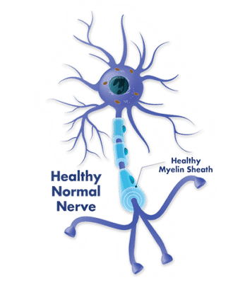RHP-nerve-image-347x400
